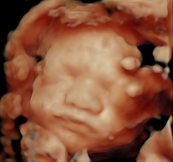 妊娠24週～のエコー検査イメージ